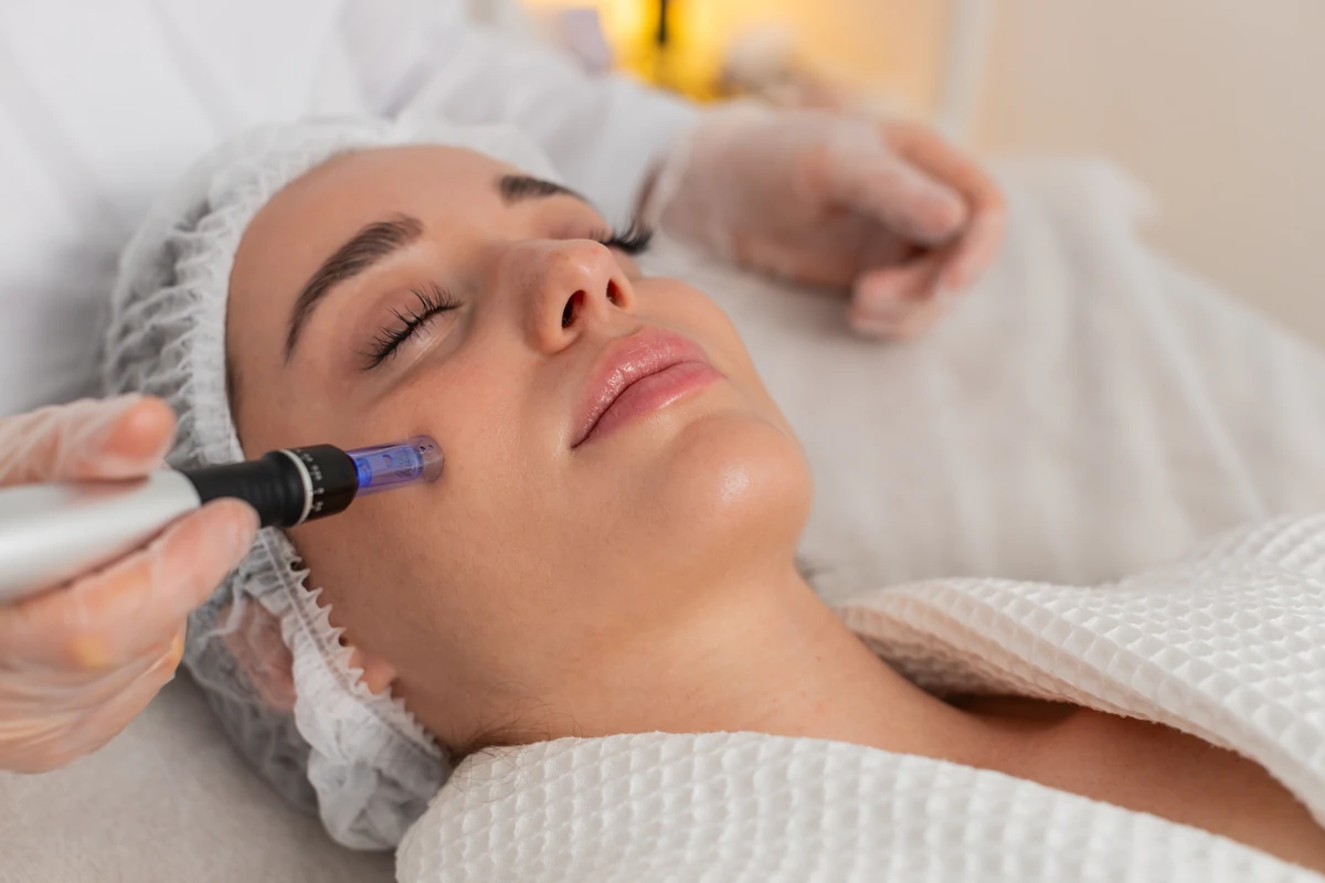 microneedling-by-aih-aesthetics-wellness-in-plainfield-il