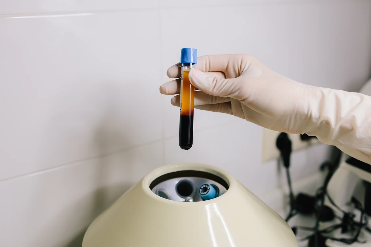 platelet-rich-plasma-prp-by-aih-aesthetics-wellness-in-plainfield-il-sec